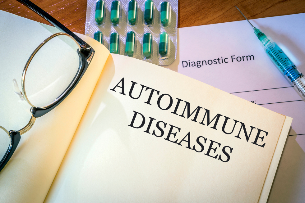 compatibility hair test and autoimmune conditions